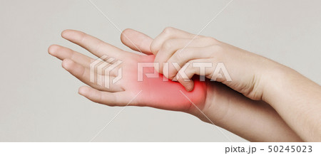 Woman scratching her itchy palm with rash Woman scratching her itchy palm with rash 50245023