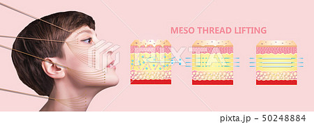Meso thread Lift. Young female with clean fresh Meso thread Lift. Young female with clean fresh 50248884