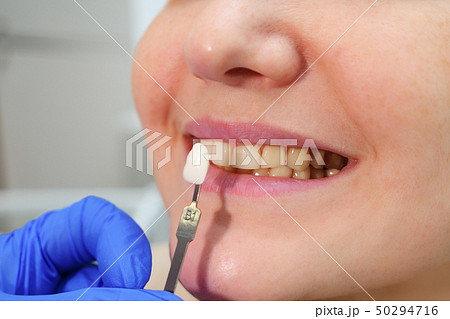 Dentist with tooth color samples is choosing shade for women patient teeth at dental clinic. 50294716