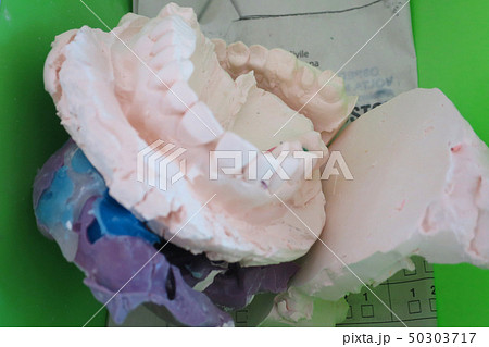 dental laboratory denture dental impressions dental laboratory denture dental impressions 50303717