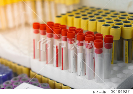 Blood sample tubes empty in laboratory test Blood sample tubes empty in laboratory test 50404927