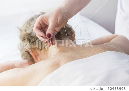 Elderly woman undergoing acupuncture procedure in  50433993