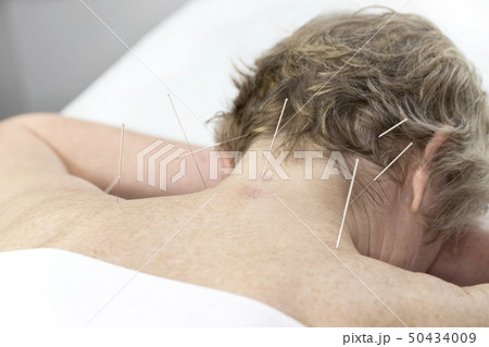 Elderly woman undergoing acupuncture procedure in  50434009
