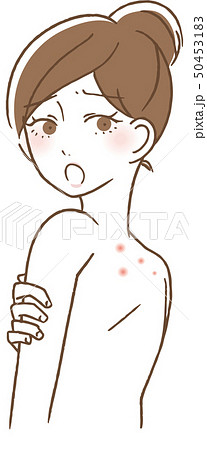 背中　ニキビ跡　毛穴汚れ　女性 50453183