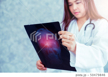 Doctor looking at patient xray film of head injury Doctor looking at patient xray film of head injury 50479846