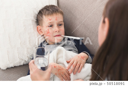 Child Boy With Measles Measuring Temperature, Lying on Sofa 50518091