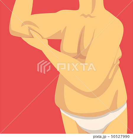 Male Torso, Man Clamping Fold of Fat Forearm with His Hand, Human Body After Weight Loss, Obesity Male Torso, Man Clamping Fold of Fat Forearm with His Hand, Human Body After Weight Loss, Obesity 50527990