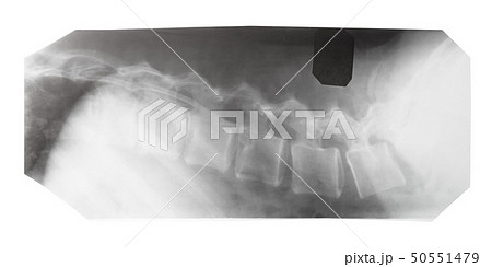 film with X-ray image of side view of human spine film with X-ray image of side view of human spine 50551479