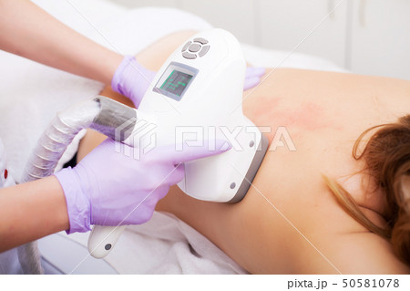 Body Care. Woman is in the process at the clinic lipomassage Body Care. Woman is in the process at the clinic lipomassage 50581078