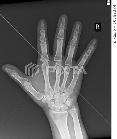 洋書【解剖学・骨格がわかる】レントゲン遊び　AMAZING X-RAYS　人体 洋書【解剖学・骨格がわかる】レントゲン遊び AMAZING X-RAYS