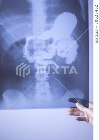 Medical xray spine hip scan 50625462