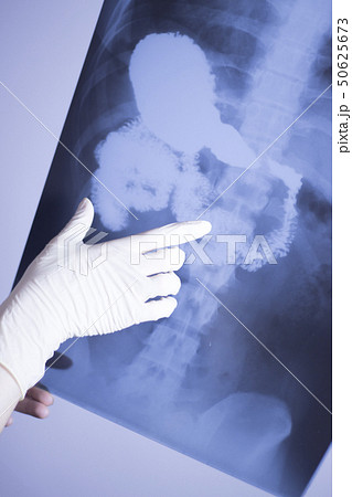 Medical xray spine hip scan 50625673