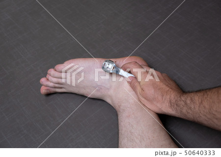 Man removing corn, callus from his feet using a razor file, masculine skin care, skin disease Man removing corn, callus from his feet using a razor file, masculine skin care, skin disease 50640333