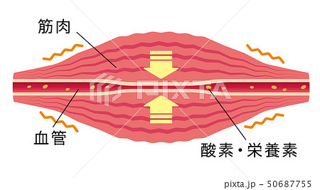 こわばった筋肉により圧迫された血管 肩こり 凝り 痛みの発生イラストのイラスト素材