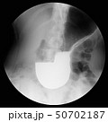バリウム検査　胃 50702187