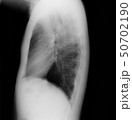 胸部レントゲン　側面 50702190
