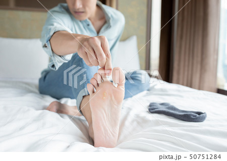 applying cream for athletes foot 50751284