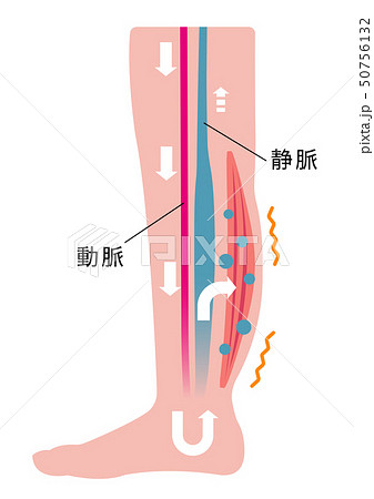 脚のむくみ 浮腫 の発生原因 過程 イラスト むくみの発生 のイラスト素材