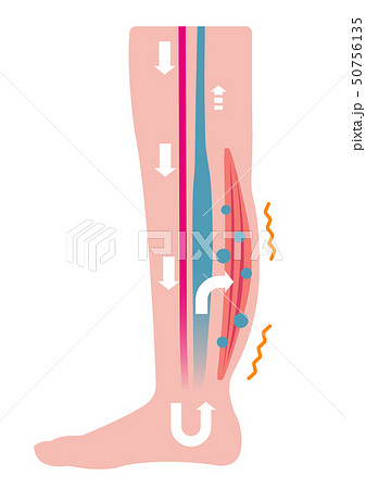 脚のむくみ（浮腫）の発生原因・過程　イラスト/ むくみの発生 (文字なし) 50756135