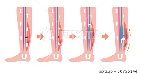 脚のむくみ 浮腫 の発生原因 過程 イラスト 文字なし のイラスト素材
