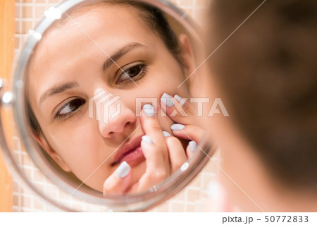 Young girl squeezes pimple on the fer face in 50772833