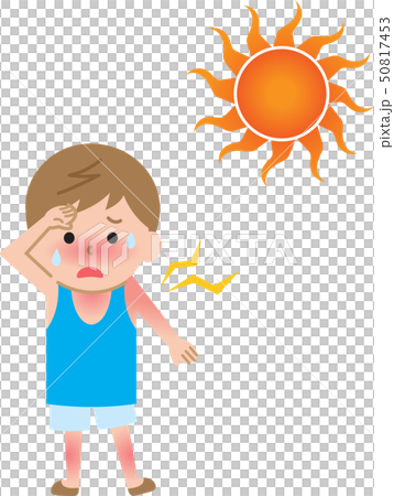 中暑曬傷男孩 50817453