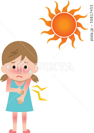 熱中症 日焼け 女の子 熱中症 日焼け 女の子 50817455