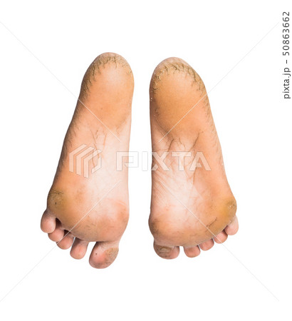 foot on white background 50863662