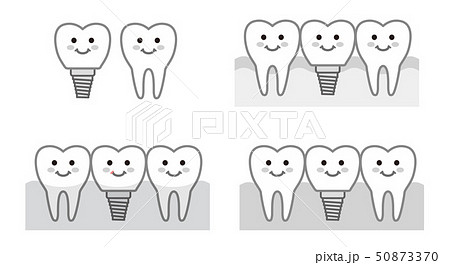 歯　インプラント　モノクロ　イラスト 50873370