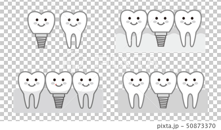 歯　インプラント　モノクロ　イラスト 50873370