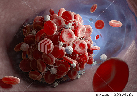 Formation of a blood clot 50894936