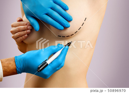 Plastic surgery before female breast correction. 50896970