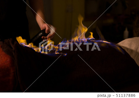 Chinese fire massage and therapy 51137886