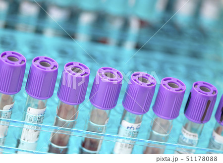 Tubes of blood sample for testing 51178088