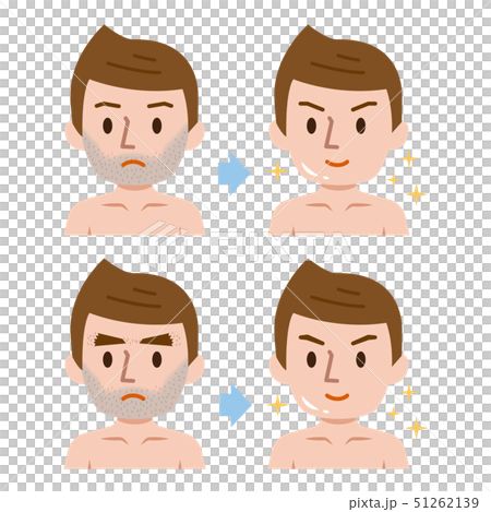 ヒゲ脱毛 男性 ビフォーアフター ヒゲ脱毛 男性 ビフォーアフター 51262139