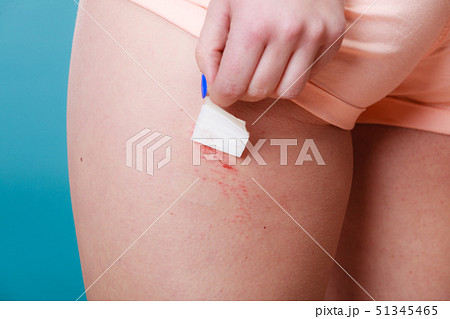 Human sticking plaster adhesive bandage to wound. 51345465