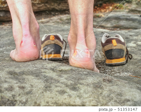 Man hiker legs without trousers and hiking boots Man hiker legs without trousers and hiking boots 51353147