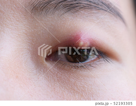 Close up of Asian young woman with brown eye with Close up of Asian young woman with brown eye with 52193305