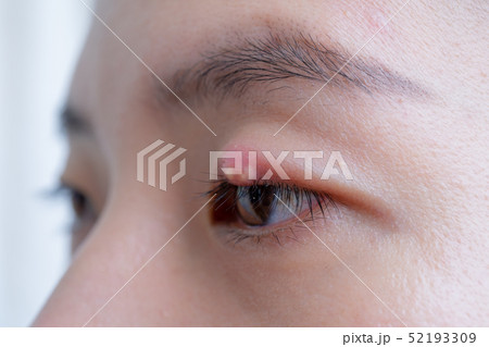 Close up of Asian young woman with brown eye with Close up of Asian young woman with brown eye with 52193309
