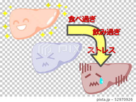 肝臟的例證 52970926