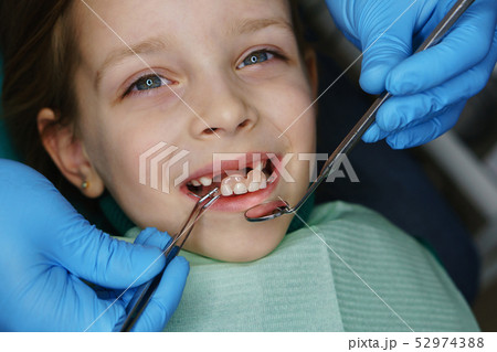 Little girl at dentist on examination. Little girl at dentist on examination. 52974388