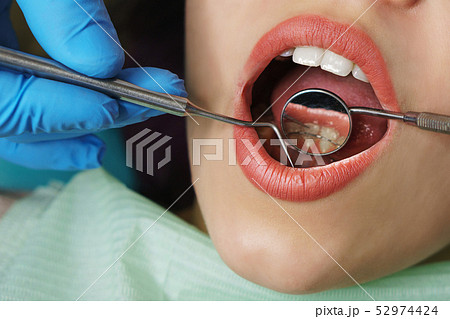 Dentist examines teeth of girl. Dentist examines teeth of girl. 52974424