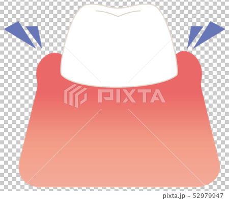 腫れている歯 イラスト 腫れている歯 イラスト 52979947