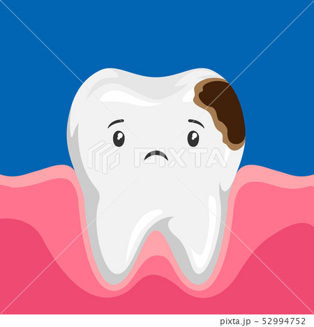 Illustration of sick tooth with caries. 52994752