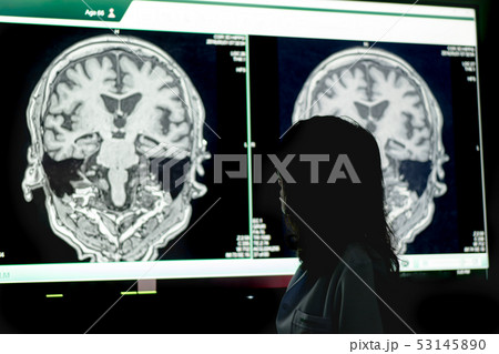 MRI indicated Dementia MRI indicated Dementia 53145890