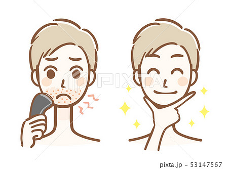 カミソリ負け　脱毛　男性　ビフォーアフター 53147567