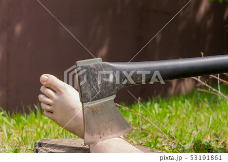 Chopping off the human leg Chopping off the human leg 53191861