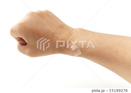 止血用絆創膏 止血用絆創膏 53199276