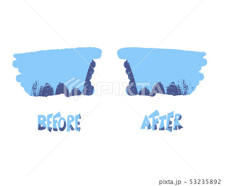 Before and after template. Vector screen elements. Before and after template. Vector screen elements. 53235892