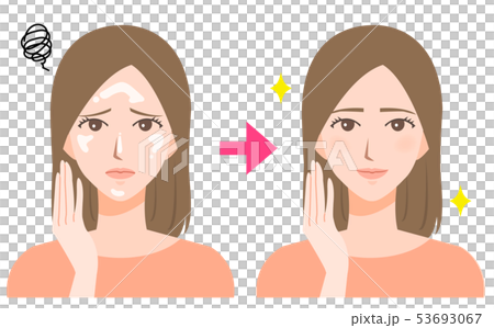 女性　てかり　ビフォーアフター　美容イラスト 53693067